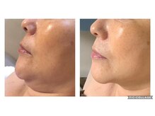 オアジスパ(Oasi Spa)/脂肪アタックジェル