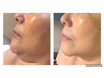 オアジスパ(Oasi Spa)/脂肪アタックジェル