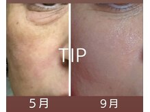 ビーピー 渋谷(b.p.)/エイジングケア　ハリツヤ