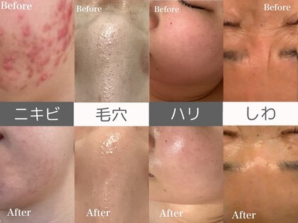 トウメイコガオ 横浜店の写真