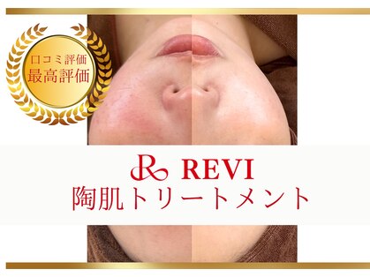 ルナージュ(LUNARJE)の写真