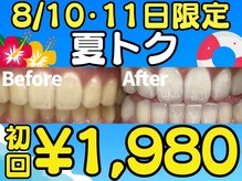 LBSホワイトニング 梅田店