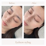 ライフズラッシュ(Lifes lash)