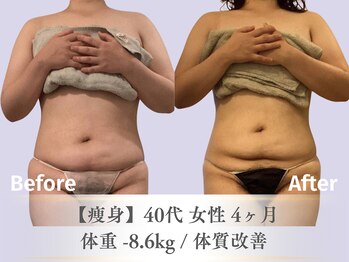 ベルペール(Belle perle)/【痩身/バスト】ハンドセラピス