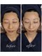 ソルテケア(SORTE*care)の写真/ほうれい線・たるみ・ハリ不足に。結果を重視した本格フェイシャルで、年齢を感じさせないハリ肌へ♪