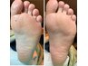 【トータル足裏角質ケア(足裏・踵)】￥8250