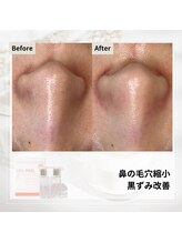 ルアナ(Luana)/ララピールの効果★