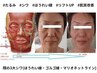 〈顔の３大シワ悩みにアプローチ〉筋膜小顔リフトフェイシャル+首肩頭皮ケア