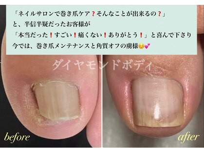 ダイヤモンドボディの写真