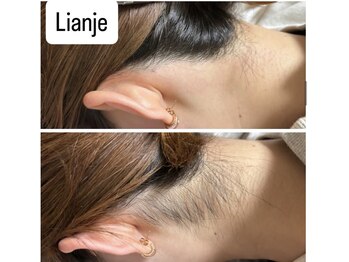 リアンジェ(Lianje)/うなじワックス脱毛