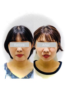 ワカヤマ 小顔(Wakayama)/☆Before・After☆