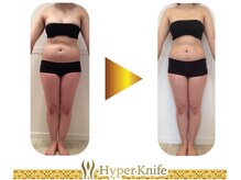 マロン(marron)/marron オリジナル　痩身