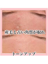 エクラーレ(Eclale)/マリムーブフェイシャルワックス