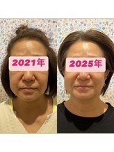 リッカ(Ricca)/驚きのビフォーアフター！！