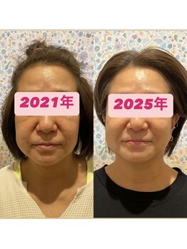 リッカ(Ricca)/驚きのビフォーアフター！！