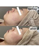 フェリノ(FERINO)/エンビロンで肌密度底上げ◎