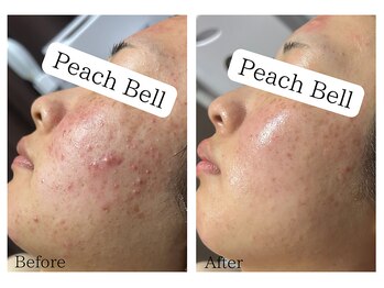 ピーチベル 美濃加茂店(PeachBell)