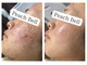 ピーチベル 美濃加茂店(PeachBell)の写真