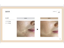 アロマビューティーサロン ジェイハウス(J)/