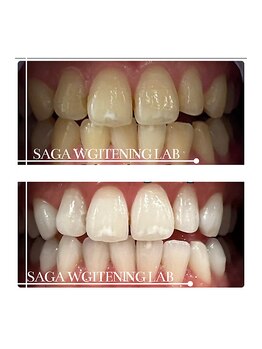 佐賀ホワイトニングラボ/