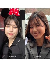 ヨサパーク ウイ(YOSA PARK Ui)/オーナーのビフォーアフター