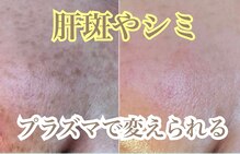 リサロン エヌ(Re salon N)