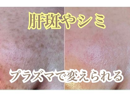 リサロン エヌ(Re salon N)の写真