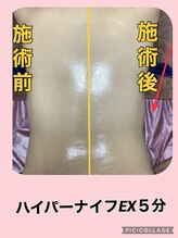 リヘッド(Re.head)/ハイパーナイフEX ウエスト集中