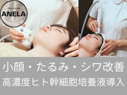 アネラ(ANELA)の写真
