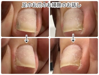 ネイルサロン イツキ(itsuki)/お爪の中の丁寧なお掃除