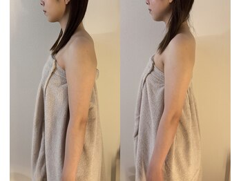 シーアイエステティック 船橋駅前店(c.iエステティック)/お顔と腕のレモンボトル