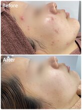 スハダビ110(suhadabi110)/before　after