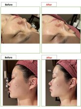 エステティック レイビス 銀座店(RAYVIS)/