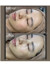 シャルム(CHARME)/ララピール