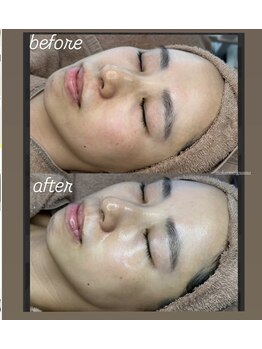 シャルム(CHARME)/ララピール