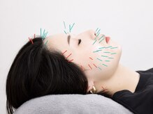 リノ ショウナン(LINO SHONAN)/変化にこだわり抜いた美容鍼