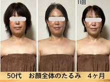 フェリーチェ(FELICE)