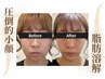 【9月末まで限定価格】脂肪燃焼剤導入×小顔コルギ×デコルテマッサージ