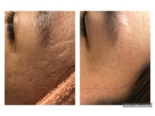 オアジスパ(Oasi Spa)/ＤＴありハーブ１回