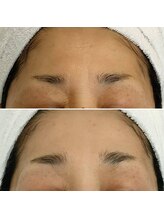 アルモ(ALMO)/透明感で圧倒的若見え！