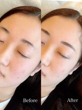 クオルーチェ(CuoLuce)/超人気♪クオルーチェHBL