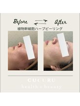 ククルヘルスビューティー(CUCURU health×beauty)/くすみケアでトーンアップ