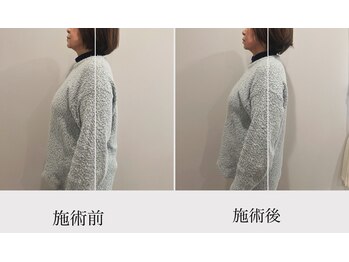 ハル(Haru)/小顔整体