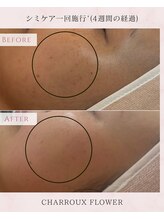 コルザフラワー(charroux flower)/シミケア