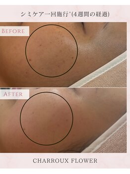コルザフラワー(charroux flower)/シミケア