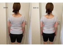 イーリス(i-ris)/美容整体×骨盤調整×リンパ