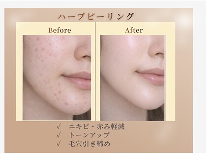 ツール(TOOL)の写真