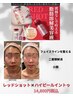 最新韓国肌管理マシン×レッドショットフェイシャル