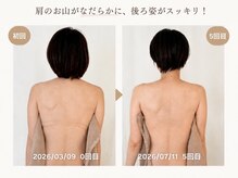 プルム(PURUMU)の雰囲気(【根本から整うボディケア】首肩こり、姿勢を整え小顔効果UP)