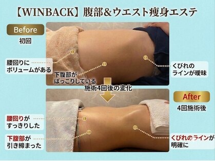 ルネアススパ 南青山(Lune’as Spa)の写真